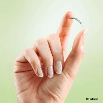 Photo d'un implant Essure